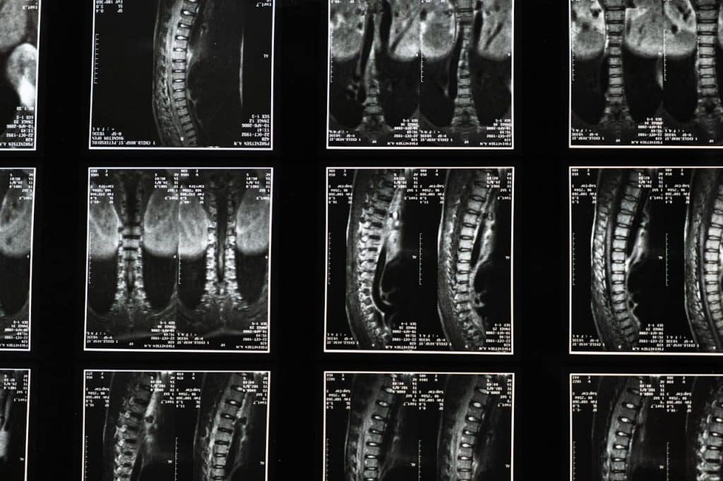 Medical Images of the Backbone